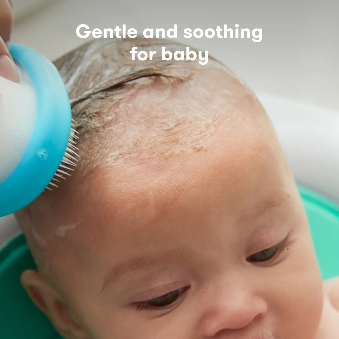 DermaFrida The FlakeFixer The 3-Step Cradle Cap System
